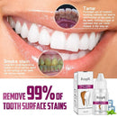 Clareador Dental 3D Perfect Whitening - RtopR®